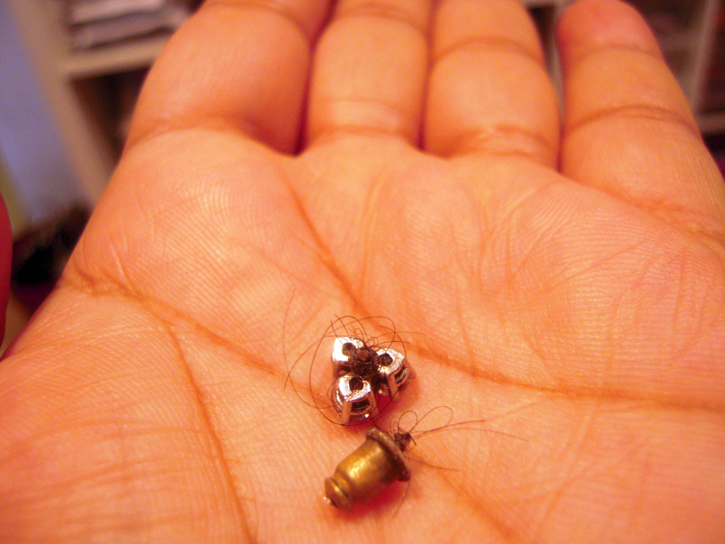 Illustration for article titled The Grossest Earring-Removal Story You'll Hear This Week